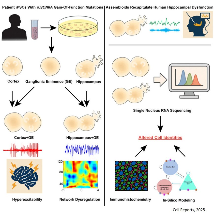 Cortical versus hippocampal network dysfunction in a human brain assembloid model of epilepsy and intellectual disability
