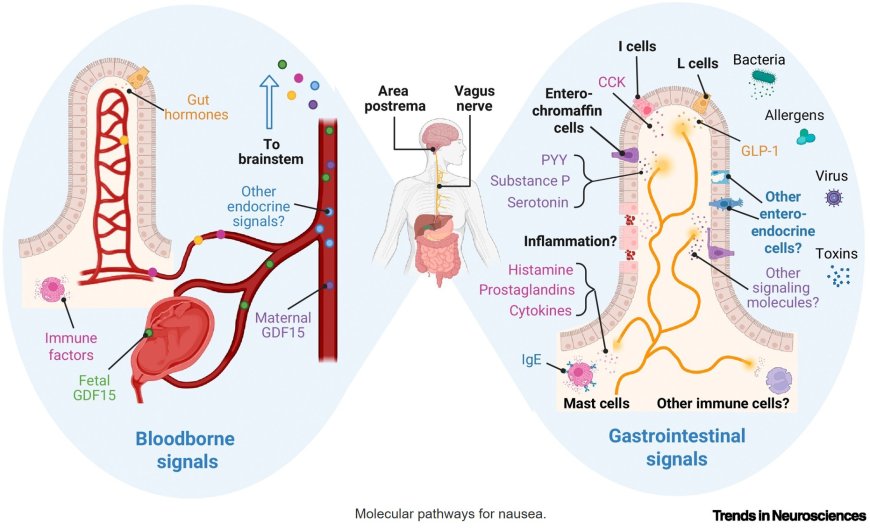 Sensory signals for nausea