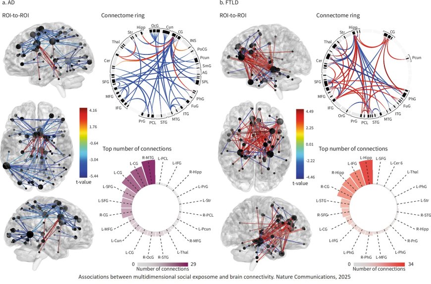 Social exposome and brain health outcomes of dementia across Latin America