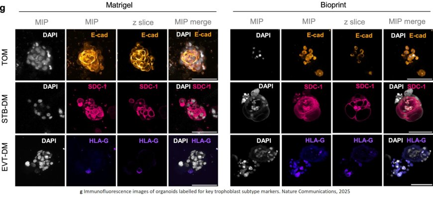 Matrix directs trophoblast differentiation in a bioprinted organoid model of early placental development