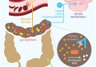 Linking chronic sickle cell pain to gut microbial imbalance