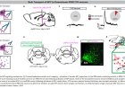 Brainstem hub for stopping pain signals from reaching the brain
