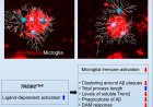 Microglial gene mutation inked to increased Alzheimer’s risk