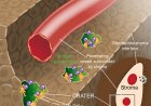 CRATER tumor niches facilitate CD8+ T cell engagement and correspond with immunotherapy success