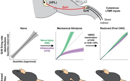 How does the brain differentiate painful from non-painful touch?