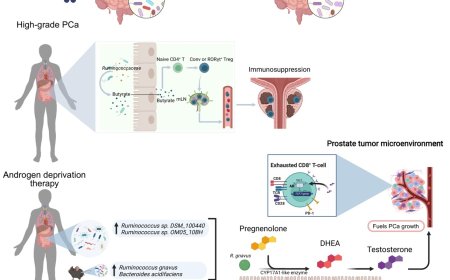 Gut microbiota–prostate cancer crosstalk