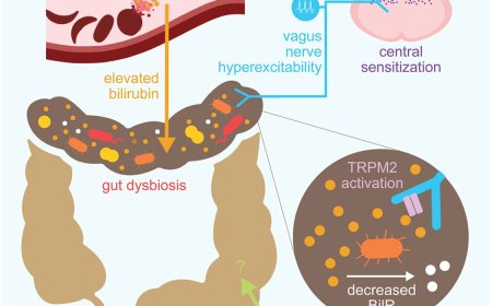Linking chronic sickle cell pain to gut microbial imbalance