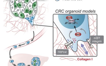 Mechanism of reprogramming of colorectal cancer cells into a fetal-like state during metastasis