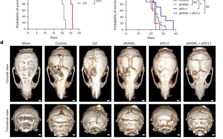 Glioblastomas affect much more than just the brain