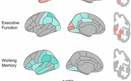 Brain’s shifting geometry tied to memory loss, dementia risk