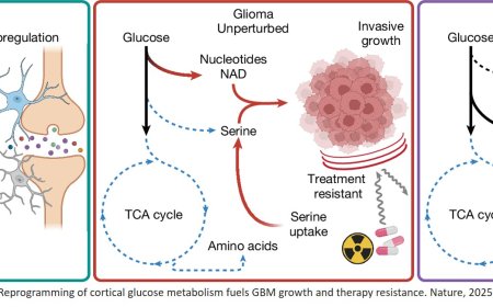 Role of serine in human brain cancer growth