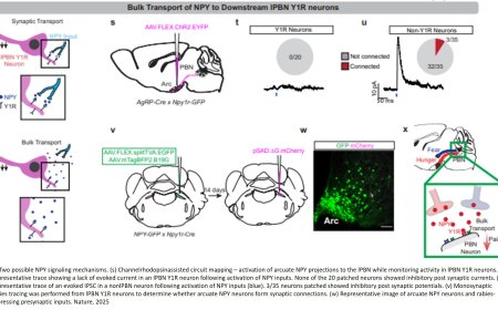 Brainstem hub for stopping pain signals from reaching the brain
