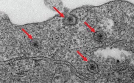How retroviruses escape endosome to infect cells