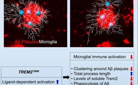 Microglial gene mutation inked to increased Alzheimer’s risk