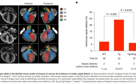 Myocardial reprogramming by HMGN1 underlies heart defects in trisomy 21
