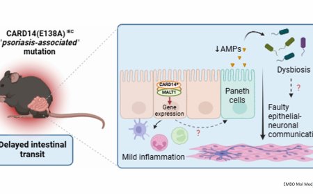 CARD14 signaling in intestinal epithelial cells induces intestinal inflammation and intestinal transit delay