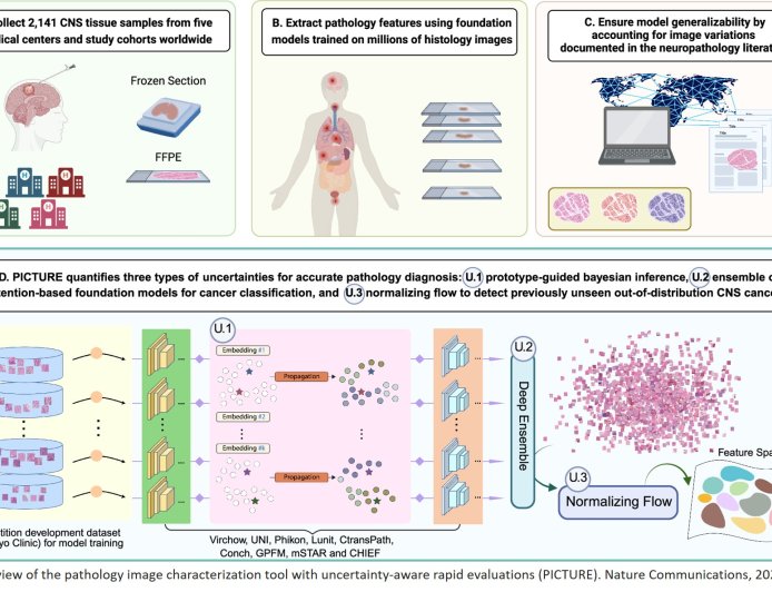 AI distinguishes glioblastoma from look-alike cancers during surgery