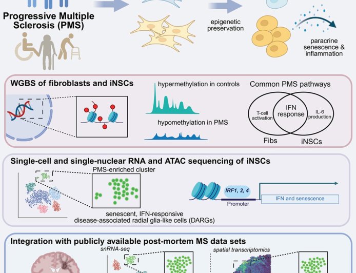 Disease-associated radial glia-like cells with epigenetically dysregulated interferon response in MS