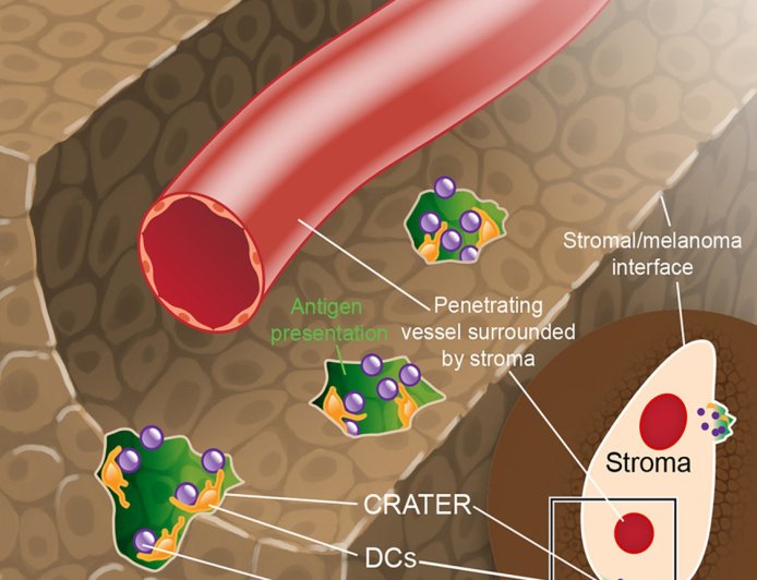 Craters on surface of melanoma cells found to serve as sites for tumor killing