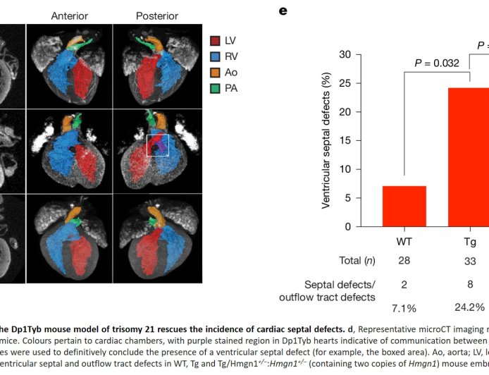 A key gene behind heart defects in Down syndrome