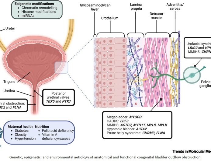 Congenital urinary bladder outflow obstruction