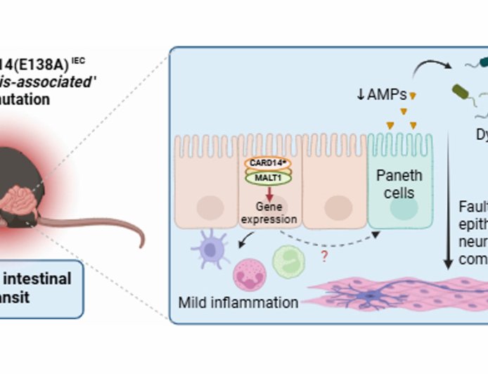 Psoriasis-linked gene mutation also impacts gut health