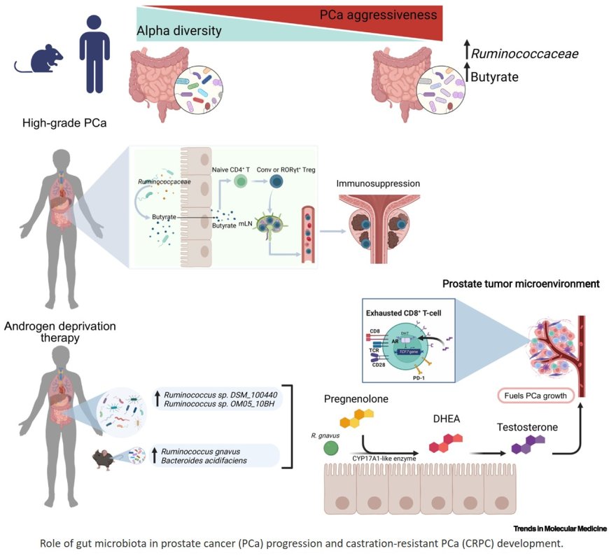 New insights into gut microbiota–prostate cancer crosstalk