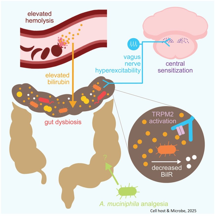 Linking chronic sickle cell pain to gut microbial imbalance