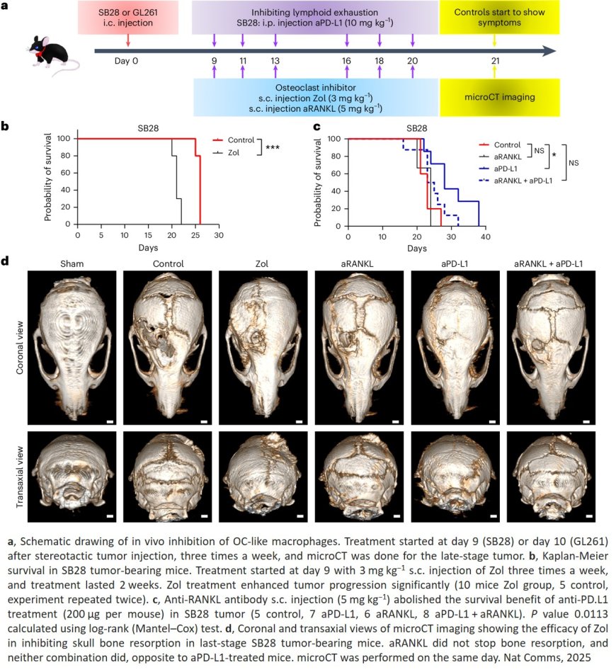 Glioblastomas affect much more than just the brain