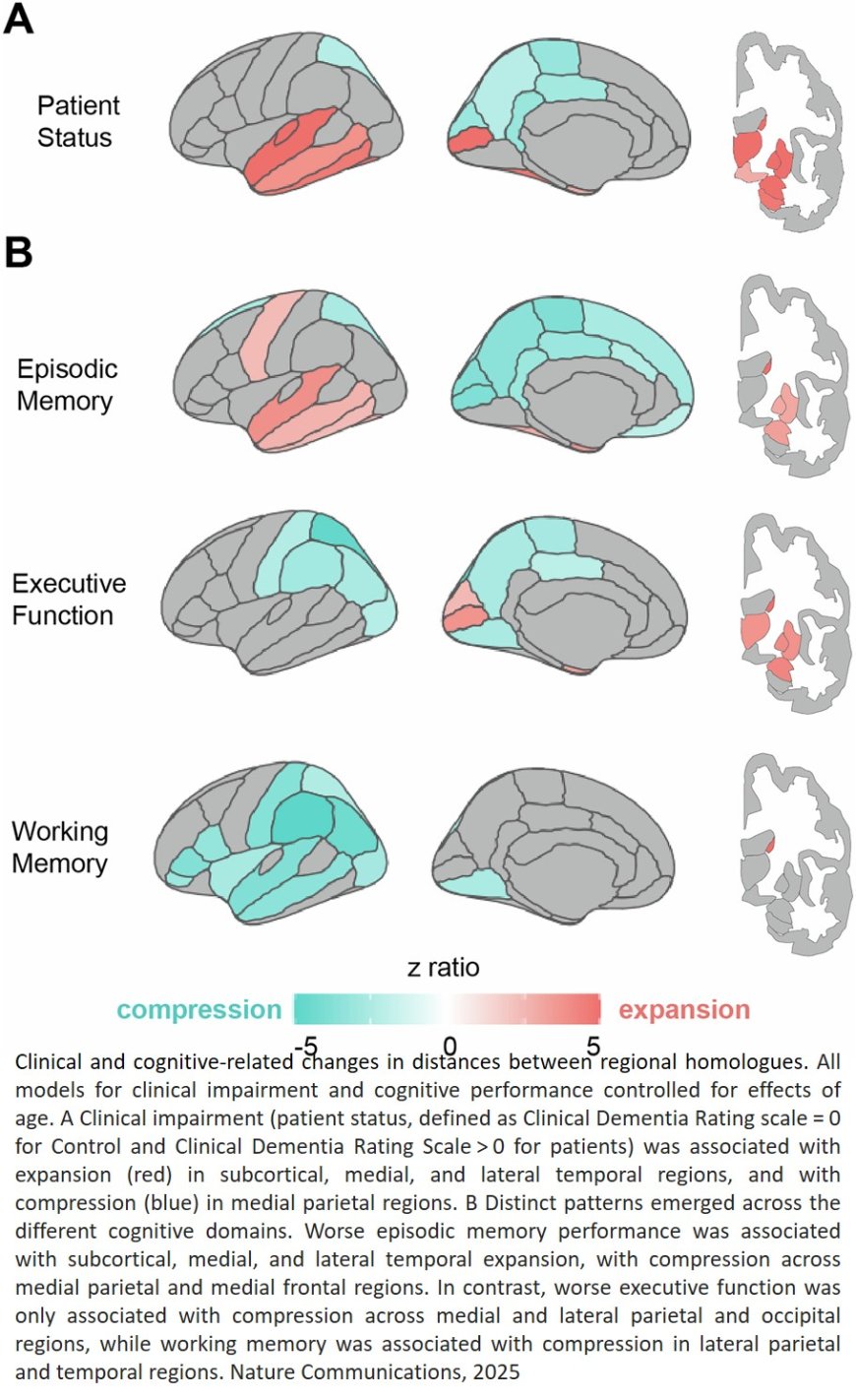 Brain’s shifting geometry tied to memory loss, dementia risk
