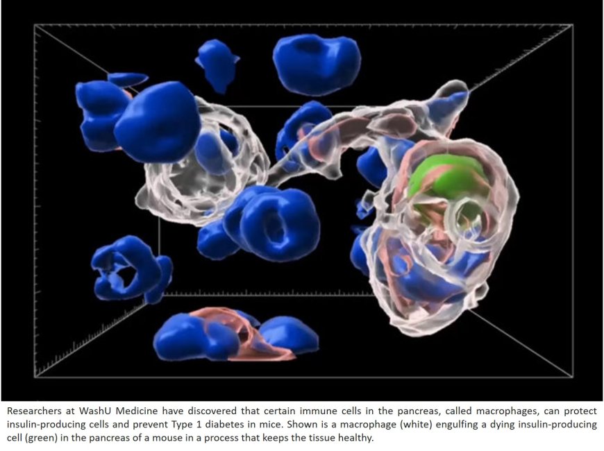 Macrophages protect insulin production in pancreas