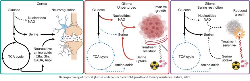 Rewiring of cortical glucose metabolism fuels human brain cancer growth