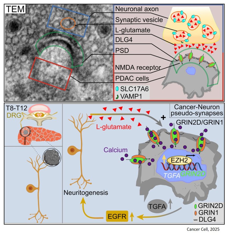 Sensory neurons drive pancreatic cancer progression through glutamatergic neuron-cancer pseudo-synapses