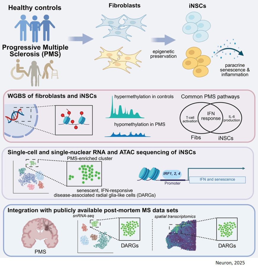 Integrated omics reveals disease-associated radial glia-like cells with epigenetically dysregulated interferon response in multiple sclerosis