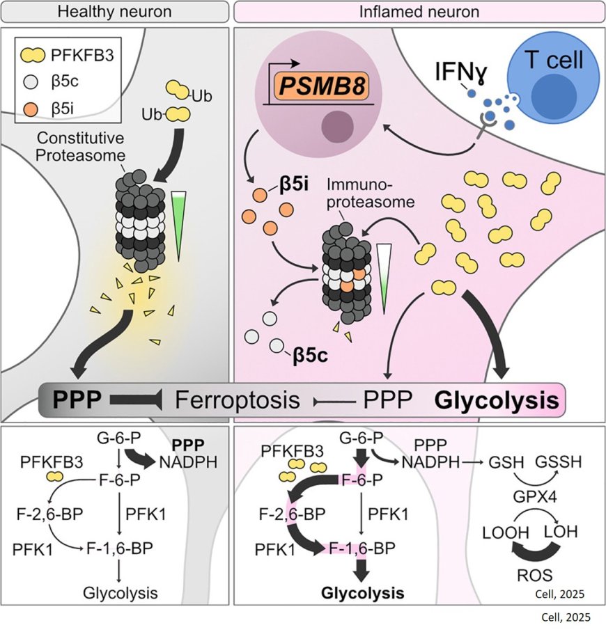 The immunoproteasome disturbs neuronal metabolism and drives neurodegeneration in multiple sclerosis