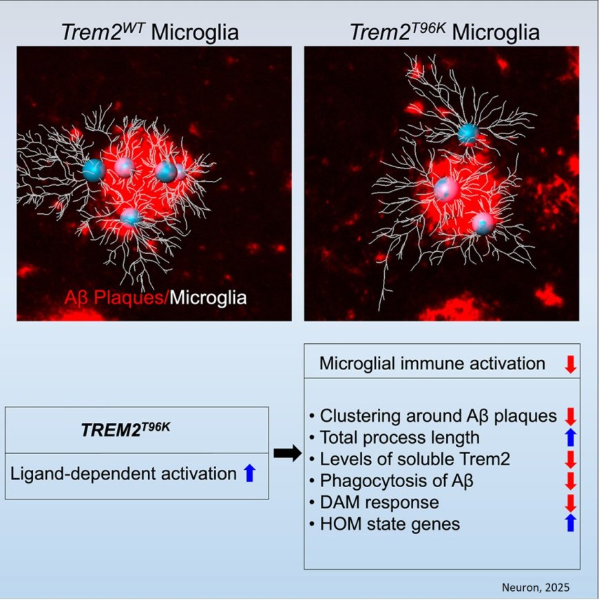 Microglial gene mutation inked to increased Alzheimer’s risk