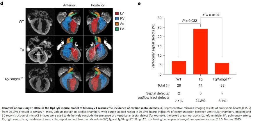 Myocardial reprogramming by HMGN1 underlies heart defects in trisomy 21