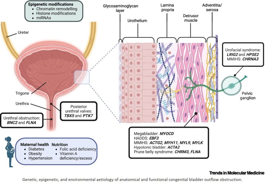 Congenital urinary bladder outflow obstruction