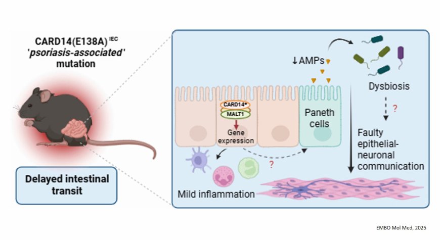CARD14 signaling in intestinal epithelial cells induces intestinal inflammation and intestinal transit delay
