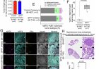Loss of transcription factor suppresses metastasis of mammary tumors