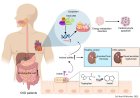 Gut-microbiota-derived indole sulfate promotes heart failure in chronic kidney disease