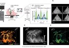 Multi-lens ultrasound arrays enable large  scale three-dimensional micro- vascularization characterization over  whole organs