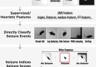 Visual detection of seizures in mice using supervised machine learning
