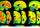 A new atlas of the human brain
