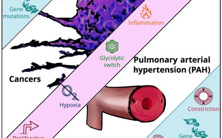 Pulmonary arterial hypertension and cancer: exploring their resemblance as channelopathies