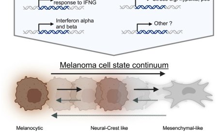 Decoding melanoma’s cellular mosaic to unlock immunotherapy potential