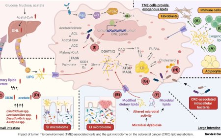 Host and microbiome lipid metabolism in colorectal cancer development and therapy