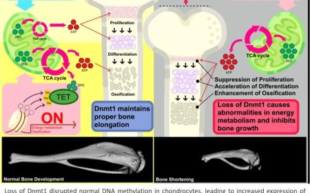 Dnmt1 determines bone length by regulating energy metabolism of growth plate chondrocytes