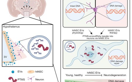 Role of parathymosin (PTMS) in aging-associated neurodegeneration
