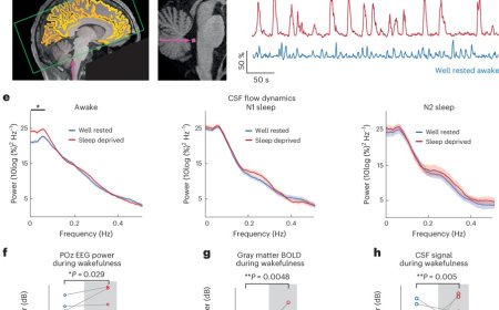 Brain without sleep!